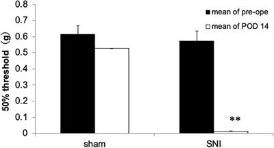 Visualization of Brain Activity in a Neuropathic Pain Model Using Quantitative Activity-Dependent Manganese Magnetic Resonance Imaging